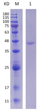 12% SDS-PAGE analysis profiles of purified MCR_RS06185-1-324 (CBB stained).